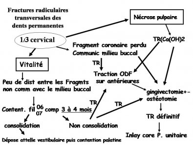 Arbre décisionnel